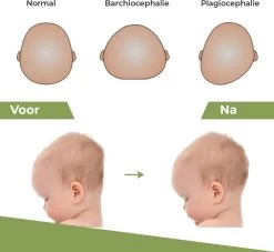 Novalits - Orthopedisch Baby Zijslaapkussen Met Traagschuim En Anti-Allergene Bamboe Microvezel Stof Om Een Plat Hoofd Tegen Te Gaan - Zijligkussen Voor Peuter - Babykussen Zijligging - Rolkussen - Steunkussen - Slaapondersteuning -Babyproducten 1200x1103 7